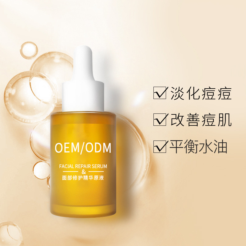 湘潭市_祛痘精华原液OEM
